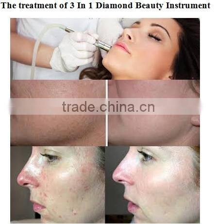 microdermabrasion and oxygen jet facial activation equipment for sale