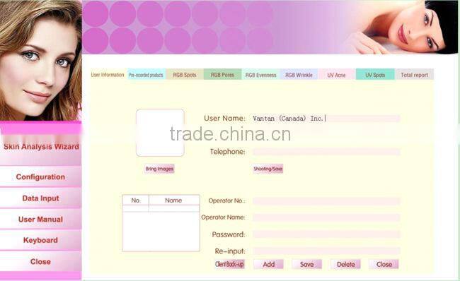 HOT SALE : Auto-digital smart mini skin analyzer handheld skin analyzer