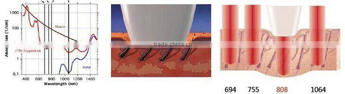 Sanhe CE approved 808nm diode laser hair removal / 808nm didoe laser hair removal machine