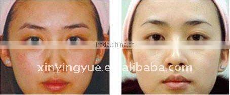 skin care oxygen equipment oxygen jet beauty machine