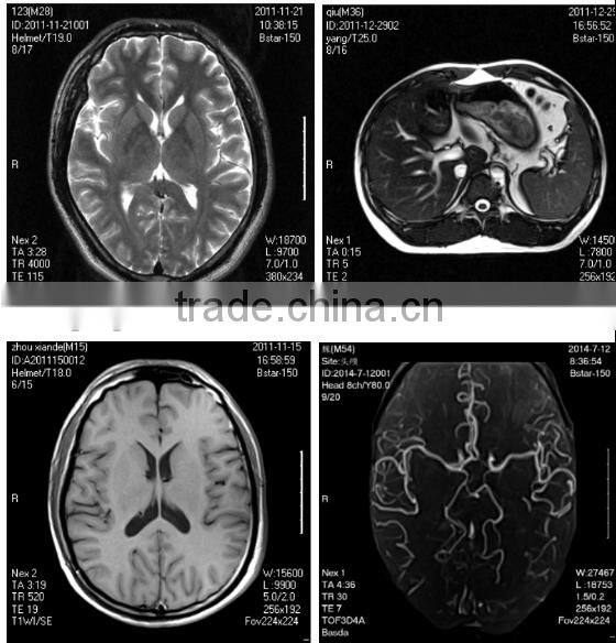 superconductive MRI machine