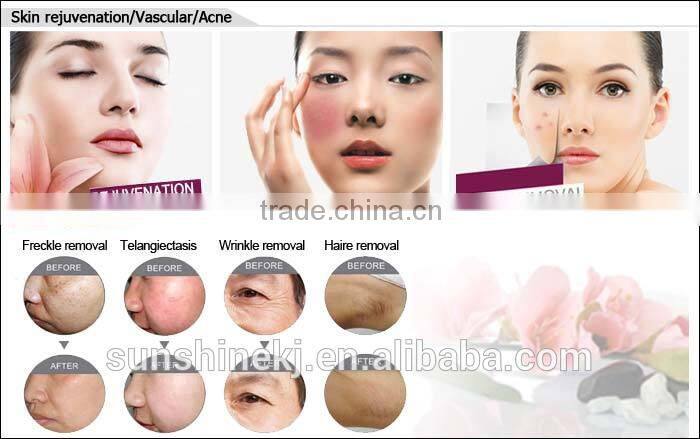 2015 New vertical diode laser 808nm software