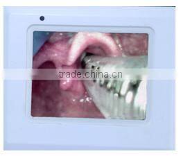 Uheal anesthesia intubationscope portable reusable video endoscope