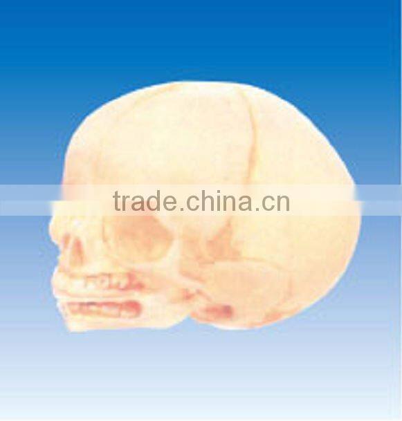 Infant skull model