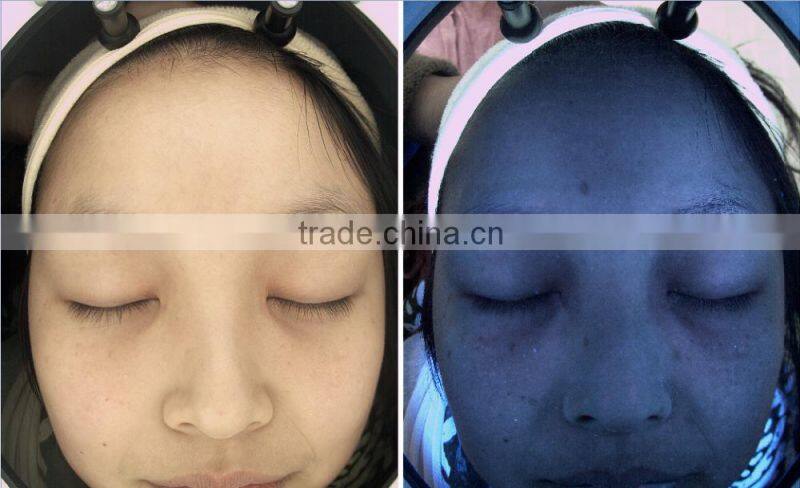 Multi-language magic mirror skin analyzer with CE certificate