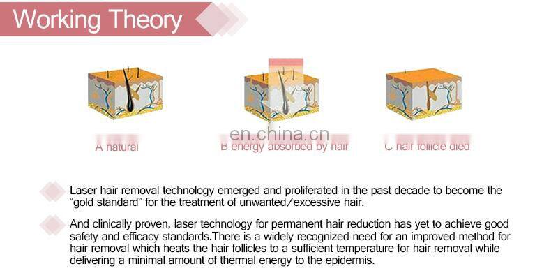 Alma Soprano ICE 808 hair removal machine Israel Germany laser