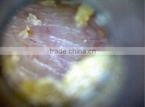 doctor mini USB Otoscope Camera