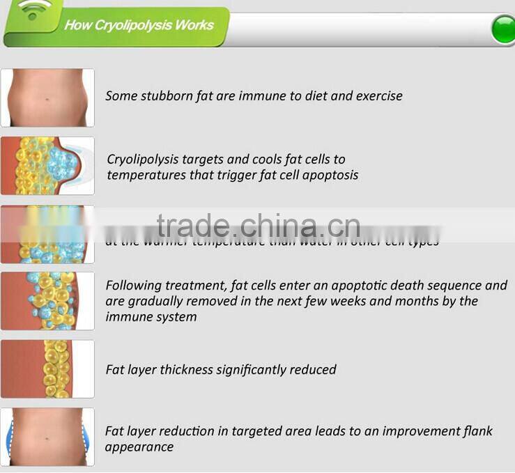 BD06A beauty machine 10m rf cocoon beauty tighten cryo therapy system cryo