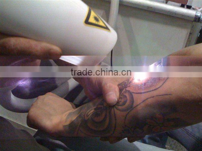 (2013 Hot sales) MINI pigment removal tattoo removal laser machine OB-TR 03