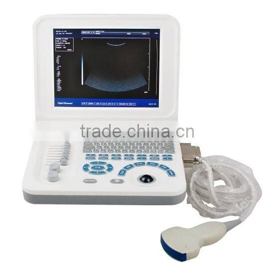 Full Digital Laptop B&W ultrasound system Ultrasound Scanner Ultrasound machine