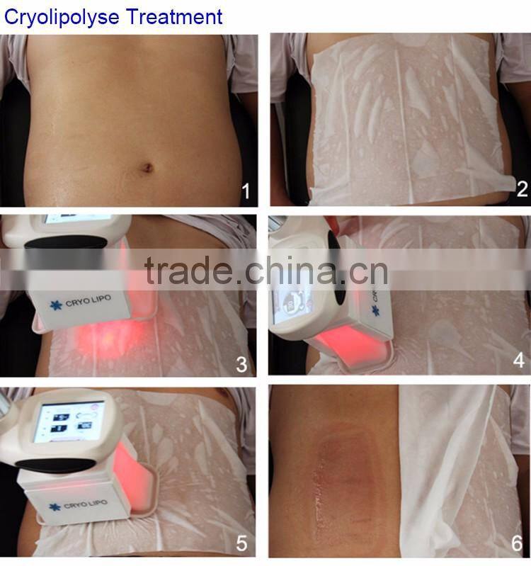 Portable kryolipolyse with two heads weight loss beauty machine