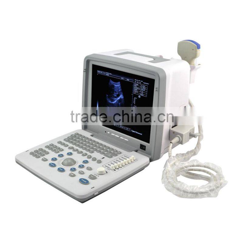 2016 Large Screen Cheapest Portable Ultrasounic Diagnosis Scanner Machine System with Convex/ Linear Transducer and Sony Printer