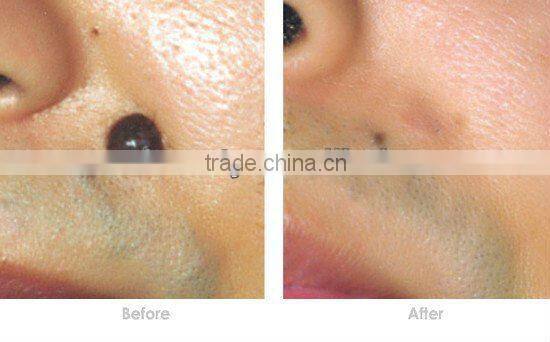 Hot!! Newest and best effective Beauty salon equiment for skin rejuvenation