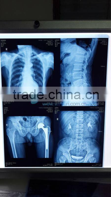 HD Medical Film Special Ink