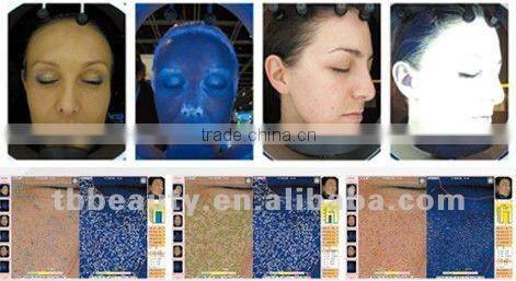Magic mirror system beauty equipment