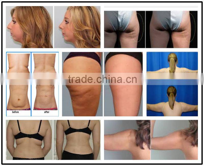professinal kim 8 slimming system for body slim