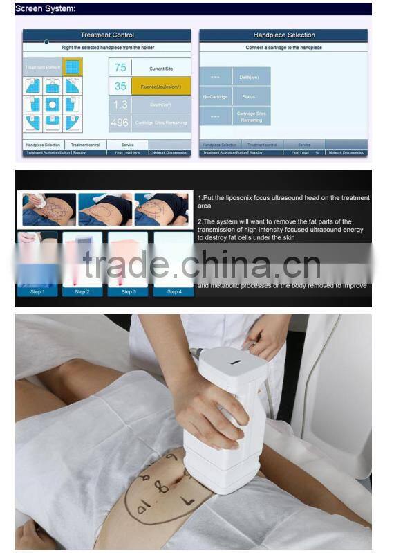 2016 Amazing result ultrasound liposonix cellulite removal device for sale