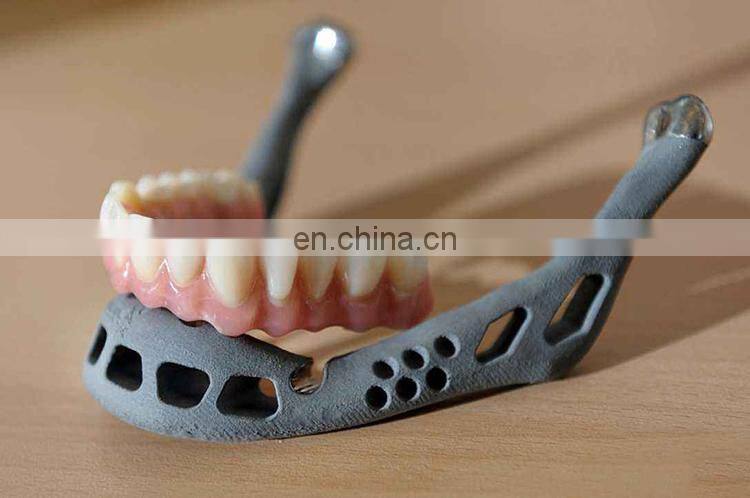 High Precision 7075 Aluminum Stainless Steel 304 Car Parts Casting Parts with SLM 3D Printing