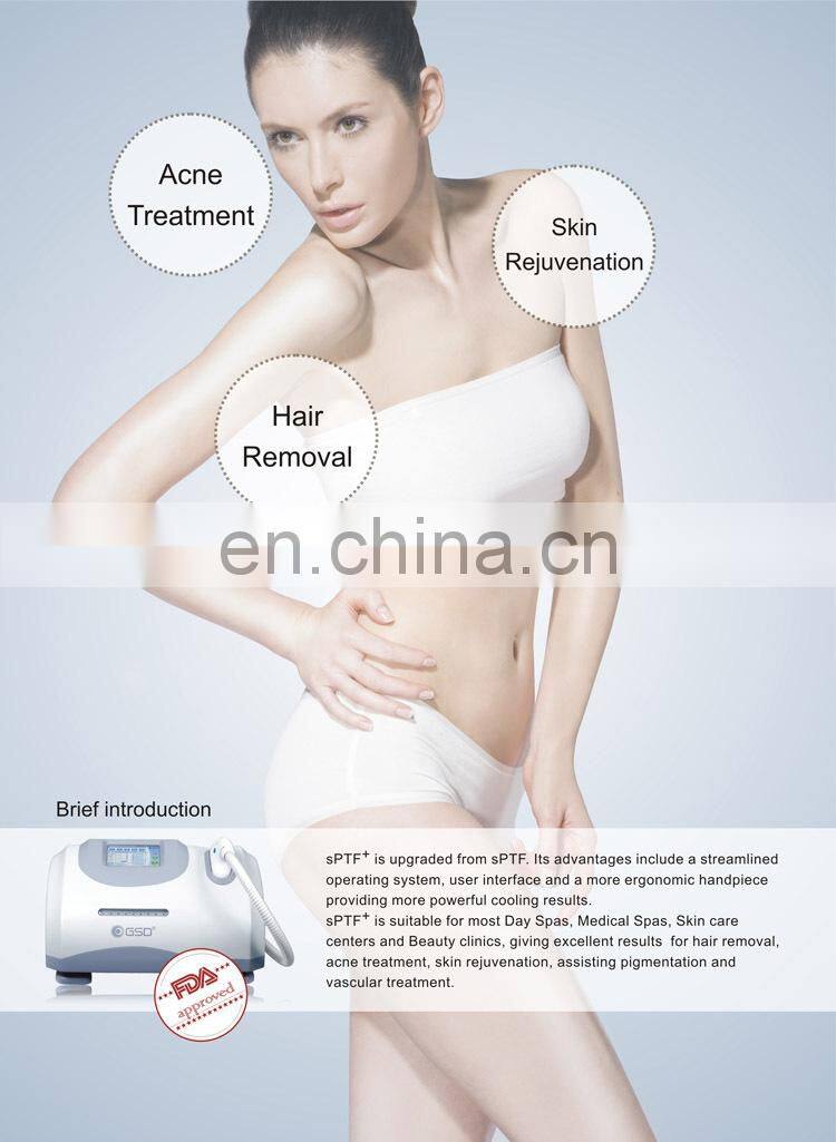 2015 TOP Sale IPL SHR Laser /Europe ipl shr laser/ 2 in 1 ipl shr device