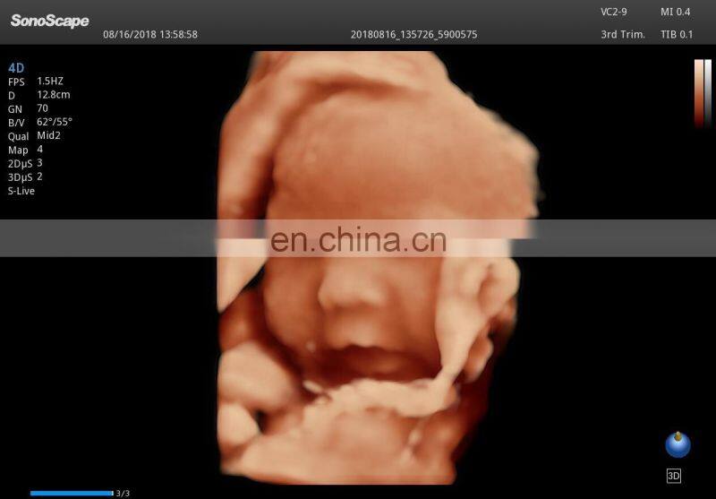 Competitive hospital medical equipment trolley Sonoscape 4d /Ultrasound scanner /Sonoscape S50 Elite