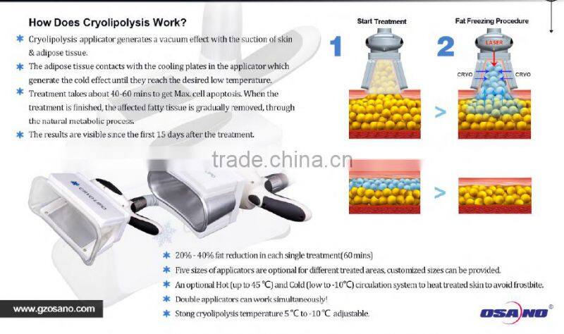 Max Contour 4C cavitation cryolipolysis face slimming rf skin tightening machine