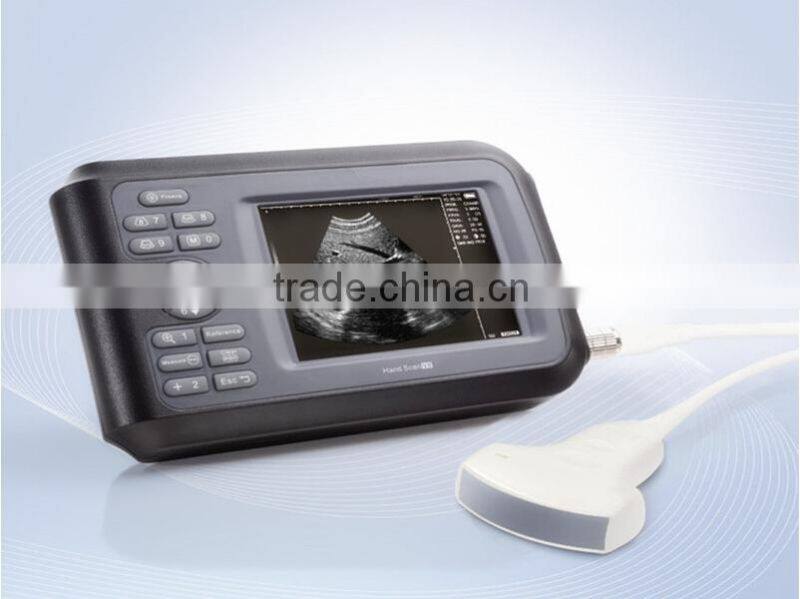 High quality CE approved Pocket ultrasound machine hand-held ultrasound scanner