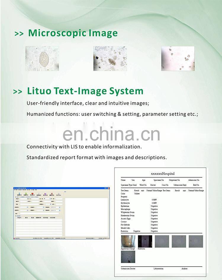 High Quality Clinical Lab equipment Fully Automatic Feces Analysis System/Feces Analyzer for stool detection
