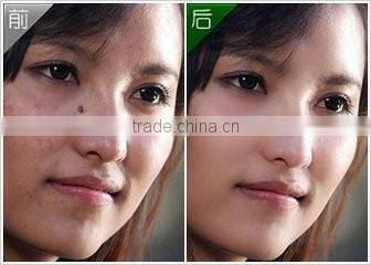 Micro Portable Handhold freckles removal pen