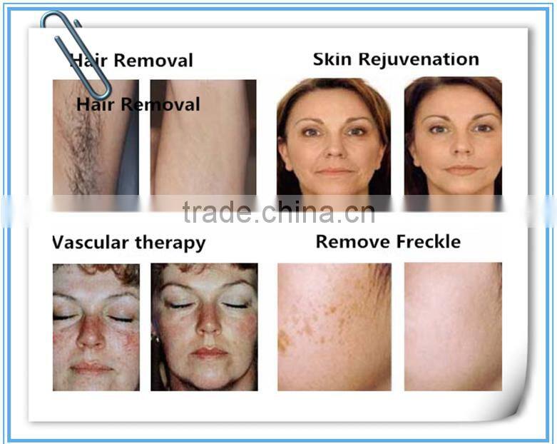 new products 2015 innovative product aft shr ipl