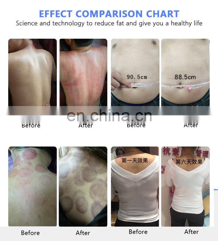 cavitation rf machine 80k cavitation slimming machine laser body cavitation