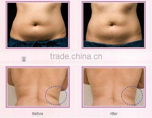 top sale!!!rf portable beauty machine,portable rf radio frequency machine