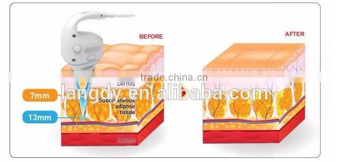 Langdai manufacturer HIFU for body slimming machine effective beauty machine for beauty salon use
