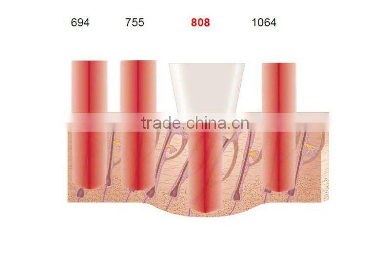 Professional hair removal machine laser diode 808 nm