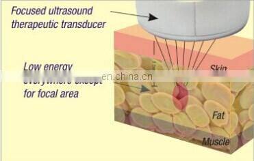 Best slimming products/ultrasonic cavitation rf slimming device
