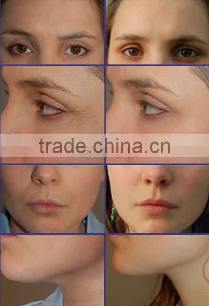 Hot!! Direct Manufacturer electro slimming machine