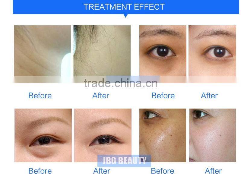 Promotion !!! New Arrival EMS Electroporation Rf Skin Tightening Bio Face Lifting Machine