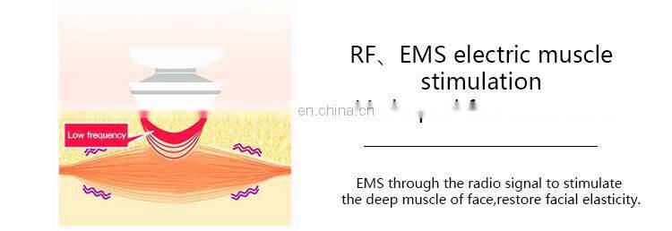 Mini RF beauty machine Radio Frequency Face lifting RF Lifting machine