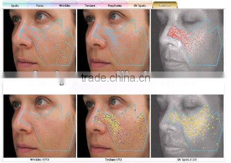 VY-FS1200 Hotsale skin test machine for skin analying