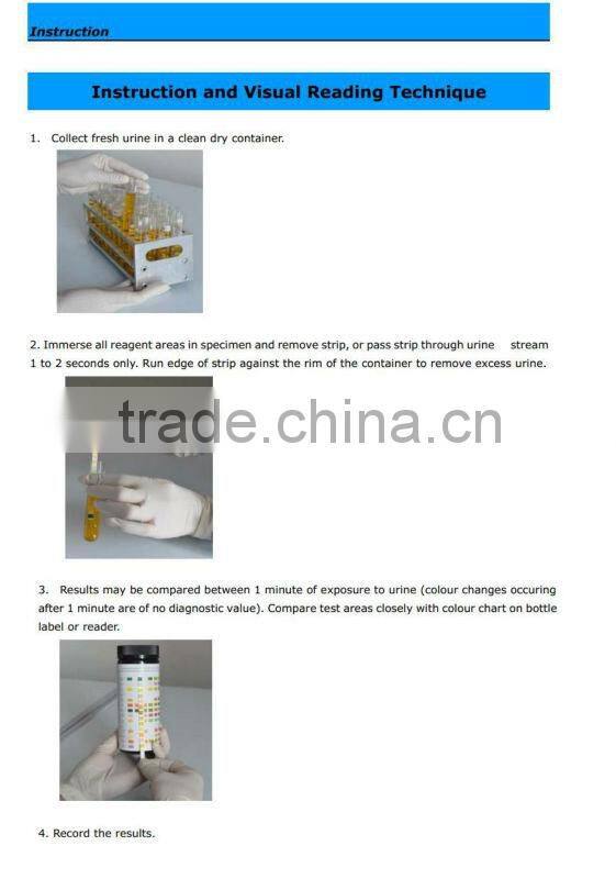 Urine Strip Analyzer