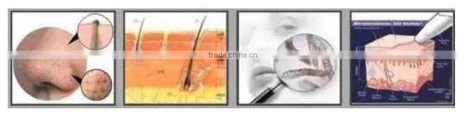 Portable Small Gas Bubble Facial Cleaning