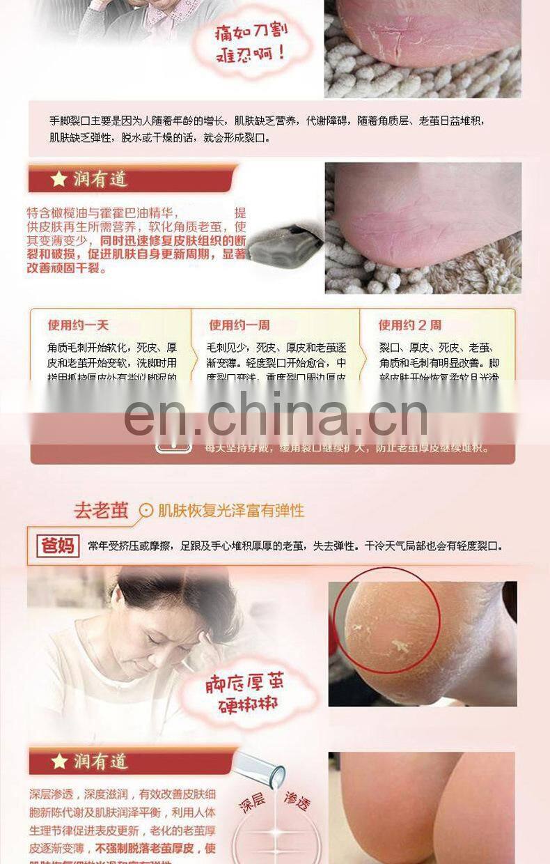 5-Toe Moisturizing Gel Socks#YG-06