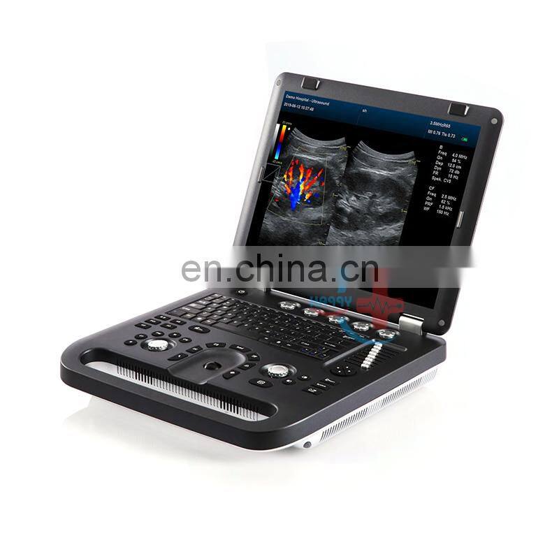 HC-A013A Cheap price  medical Laptop Color Doppler Ultrasonic Diagnostic System portable color doppler ultrasound