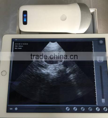 Best Price Pocket Ultrasonic Diagnostic Wireless Ultrasound Probe 10 Years Export Experience Supplier -WBU01