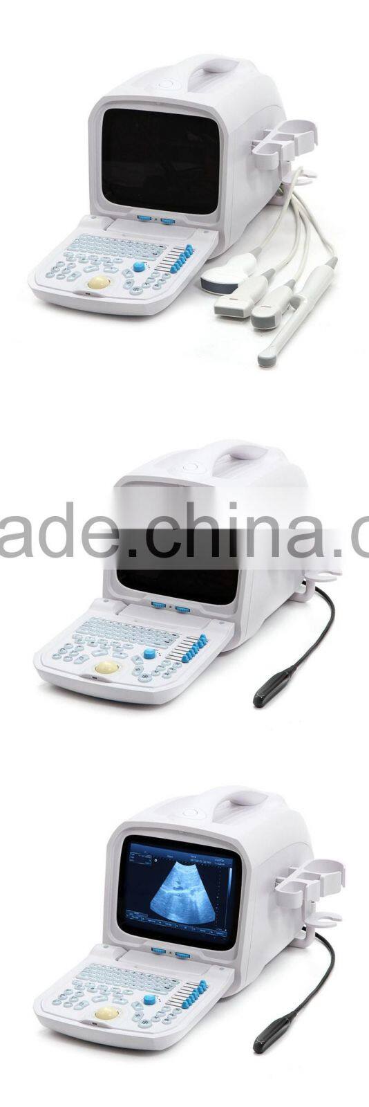 Lowe Price Medical Equipment Portable Cheap ultrasound Scanner/Machine 3.5Mhz multi-frequency Convex Probe