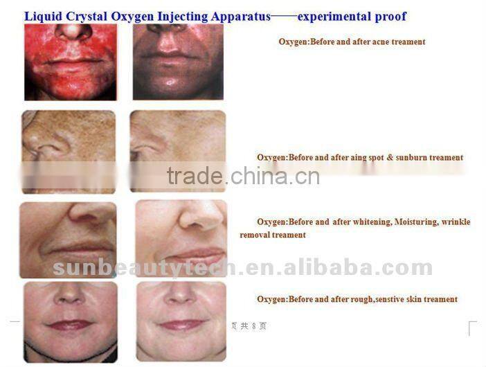Needle-free mesotherapy facial Oxygen jet peel Machine
