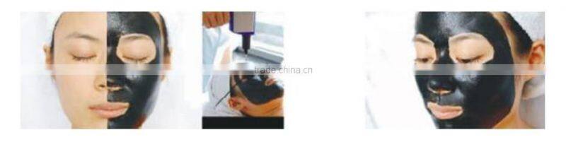 1064 532nm pigmentation removal tatoo removal nd yag laser machine prices