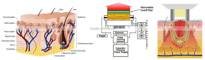 Professional ipl xenon flash lamp