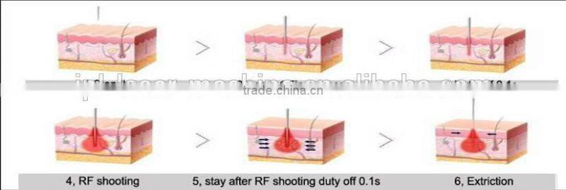 Best Selling rf fractional micro needle portable
