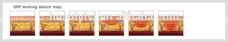 On promotion discount product microneedle fractional rf skin tightening machine