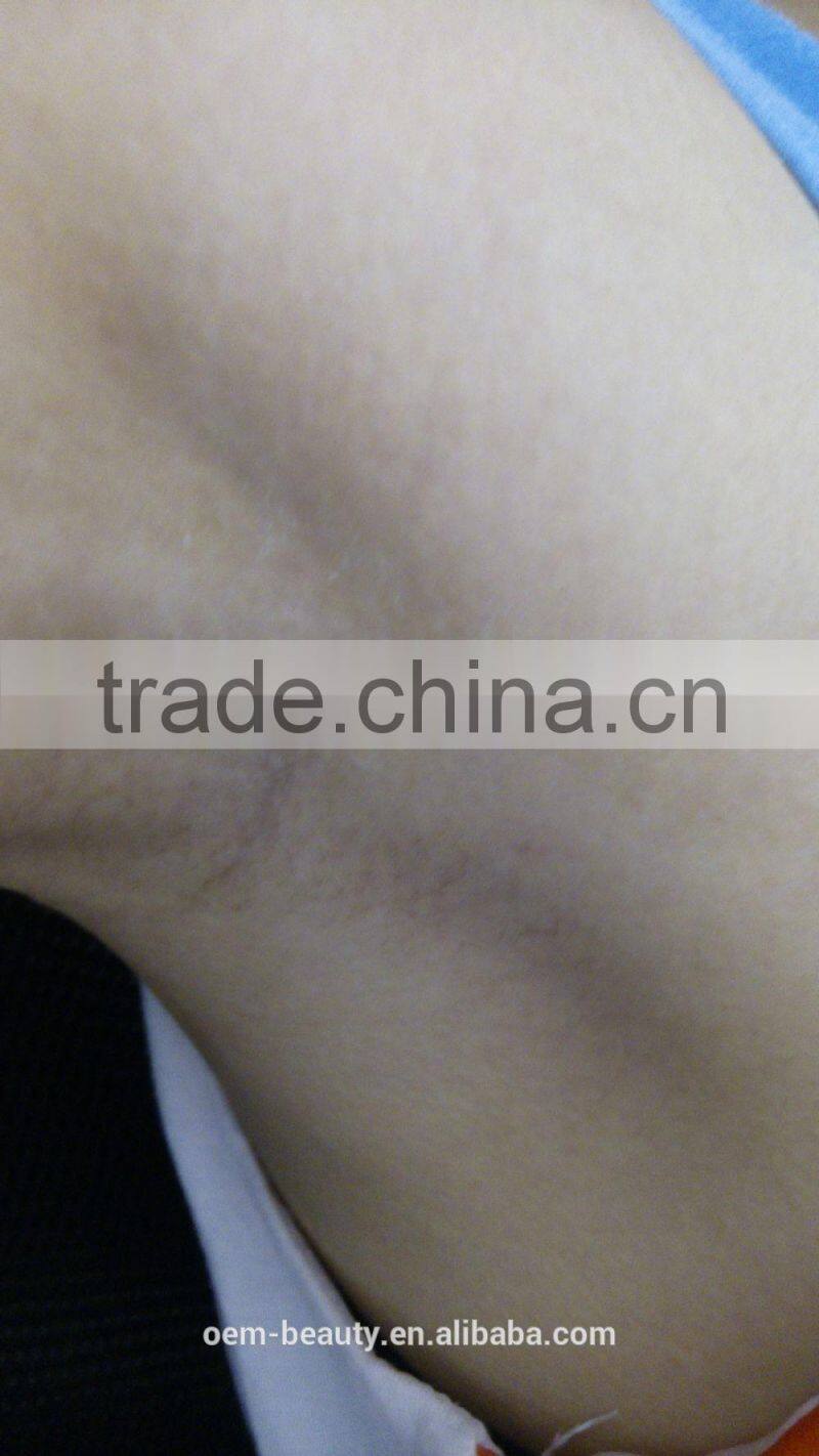 2016 Hot table Set 808 Diode Laser hair removal machine